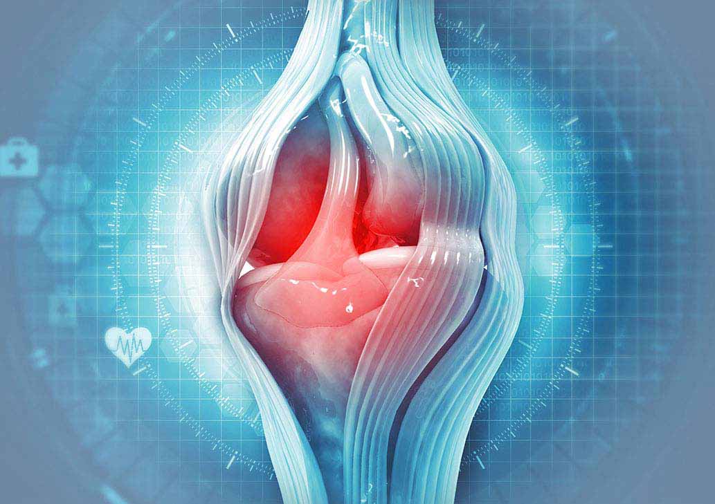 Anatomy of sore joint before Advanced Joint Pain Relief